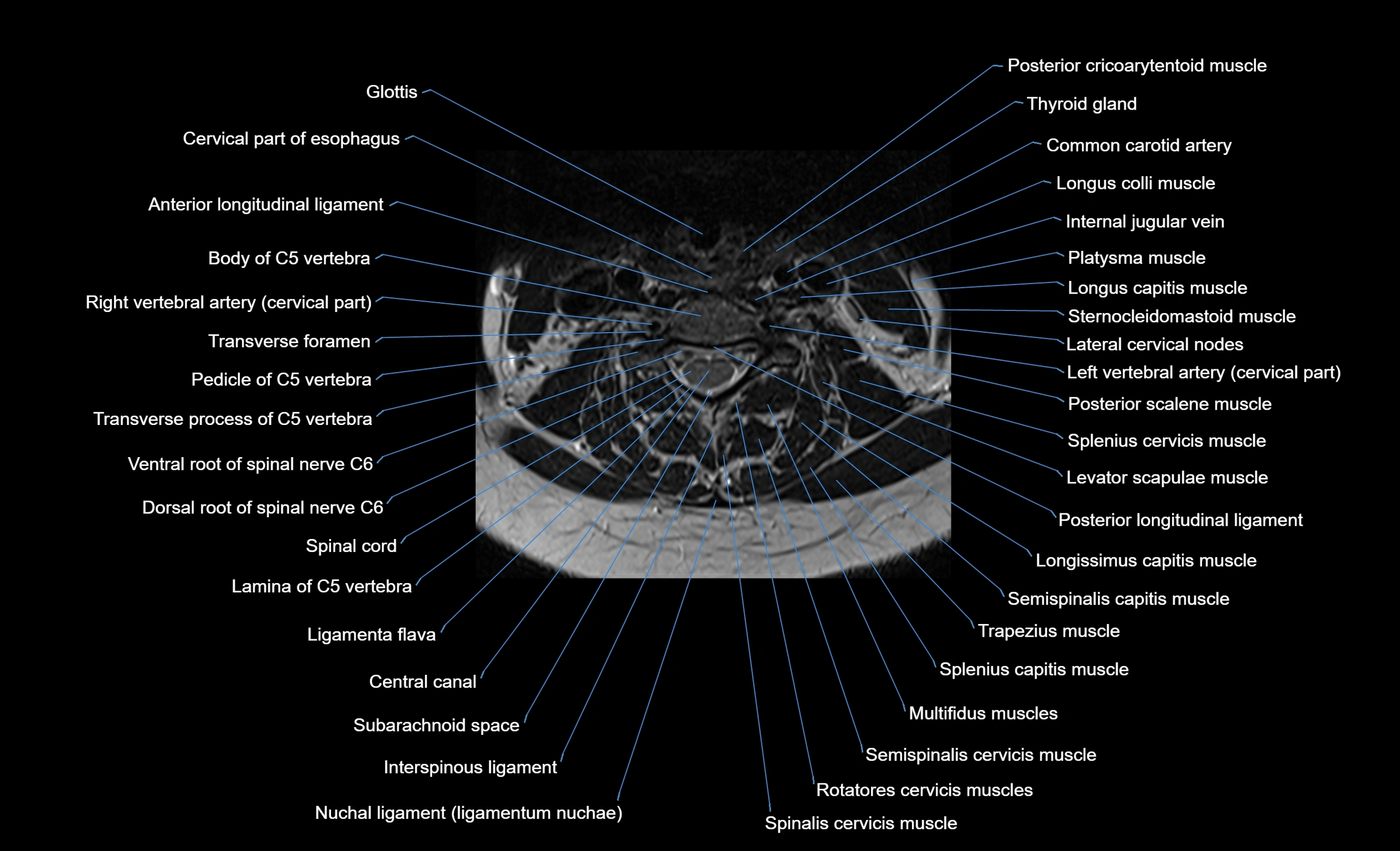 cervical spine cross sectional MRI anatomy  3T MRI axial  image-img-00001-00026.webp